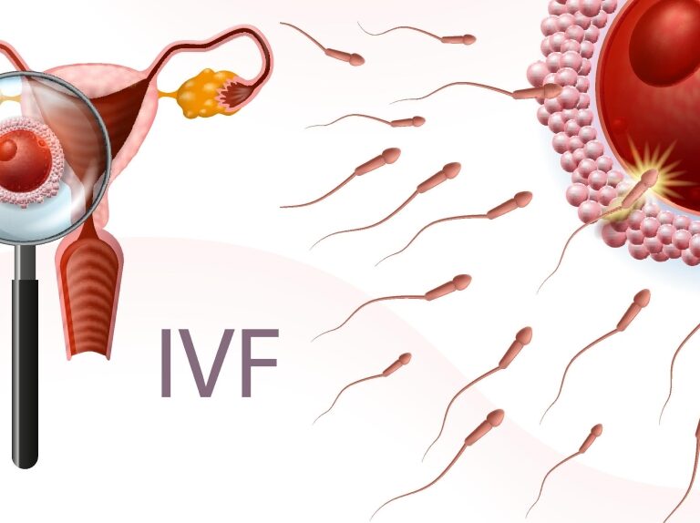IVF Hospital ahmedabad