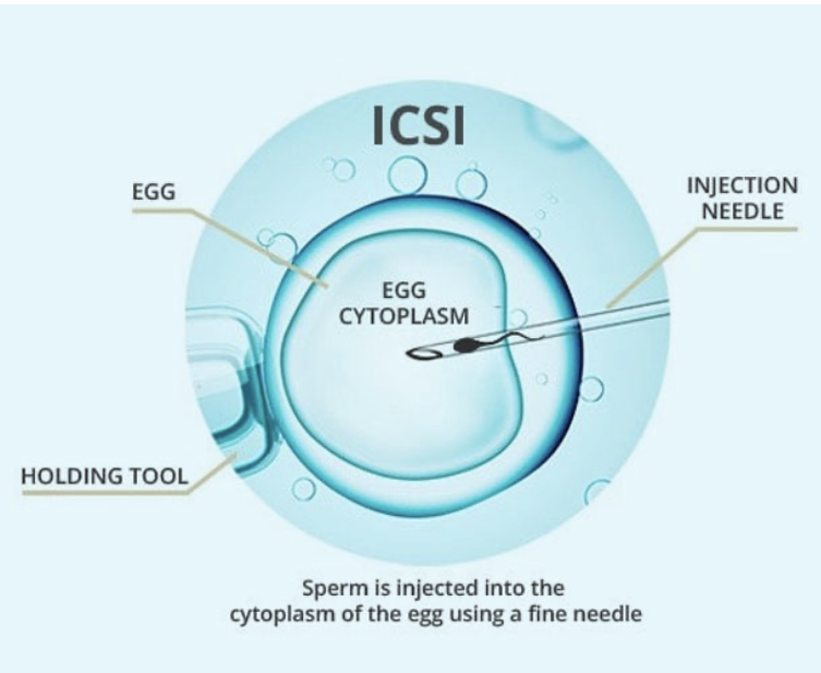 Specialized ICSI Lab